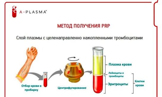 Пробірки для плазмоліфтингу (СЕРТИФІКАТ)