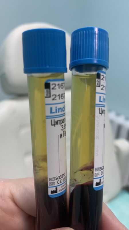 Вакуумні пробірки для плазмоліфтингу з цитратом натрію та роздільним гелем