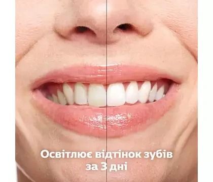 Електрична зубна щітка Philips Sonicare HX9911/88 Diamond Clean 9000